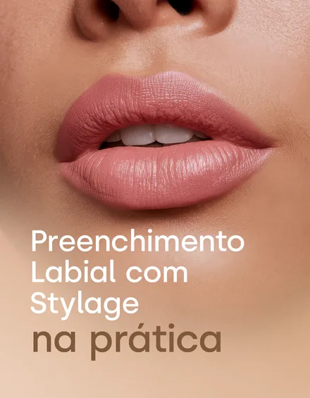 Módulo 04: Preenchimento Labial com Stylage na prática