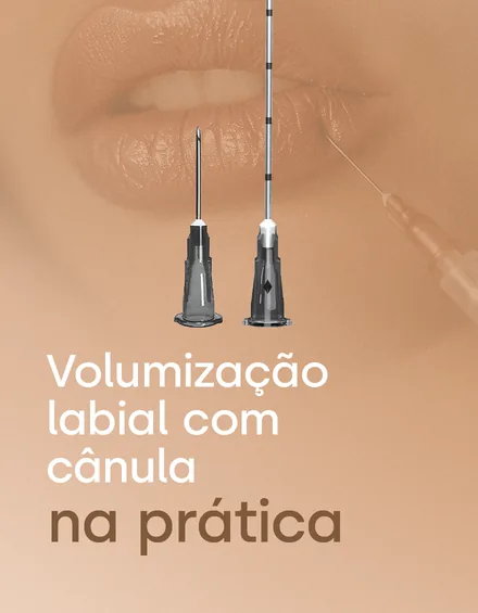 Módulo 05: Volumização labial com cânula na prática