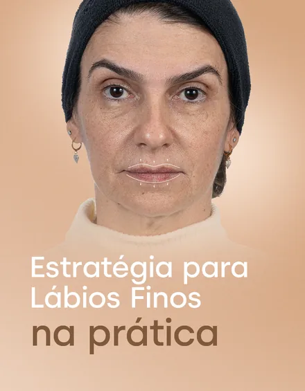 Módulo 06: Estratégia para Lábios Finos na prática
